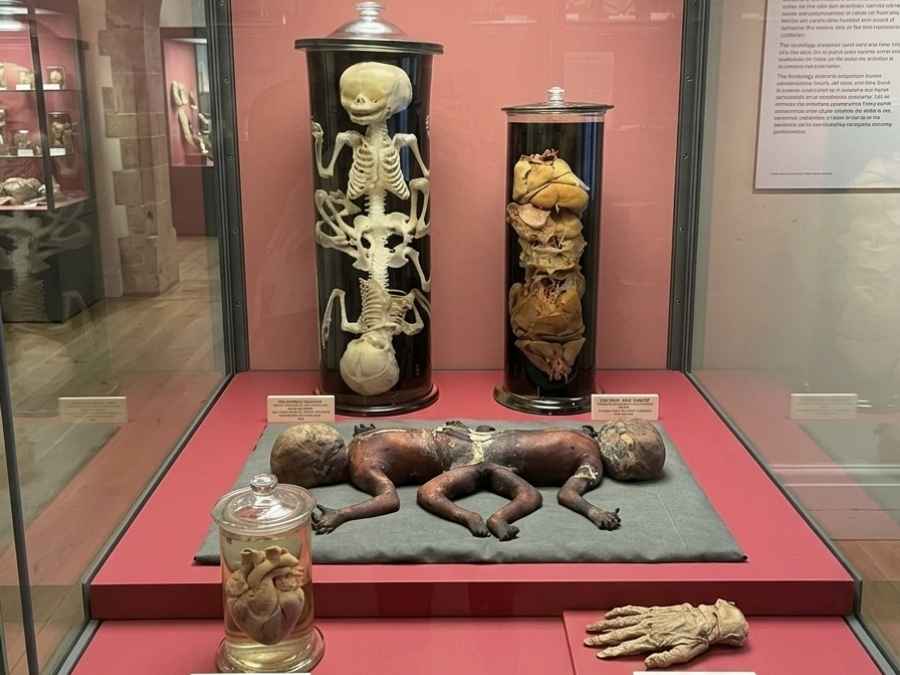 Medical Museion in Copenhagen